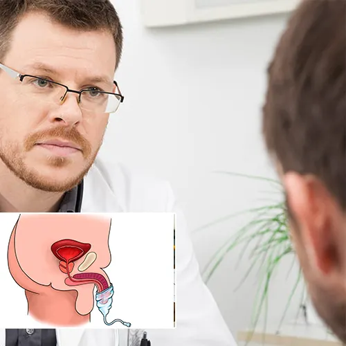 Why Choose  Urology Centers of Alabama 
for Your Penile Implant?