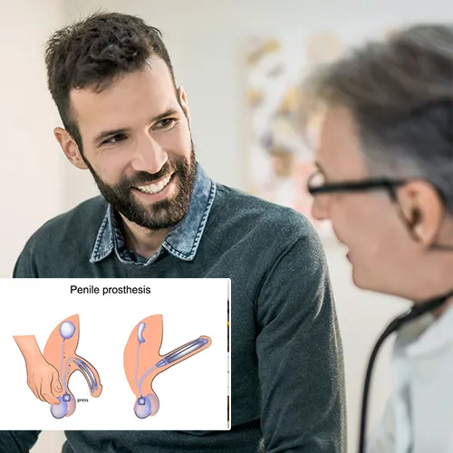 Contact  Urology Centers of Alabama 
Today for Your Penile Implant Consultation